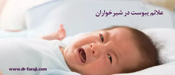 نشانه یبوست در نوزادان